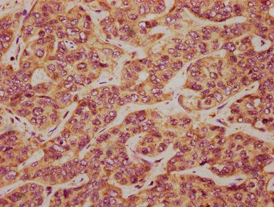 TCAF2 Antibody