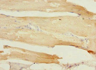 TCAP Antibody