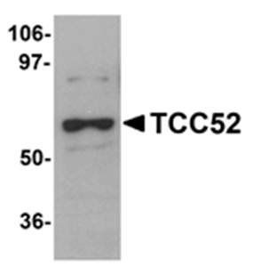 TCC52 Antibody