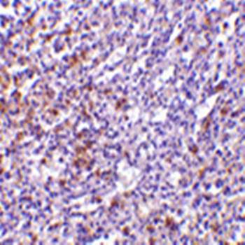 TCCR Antibody