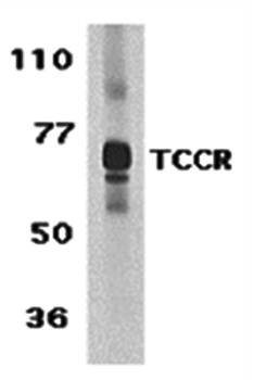 TCCR Antibody