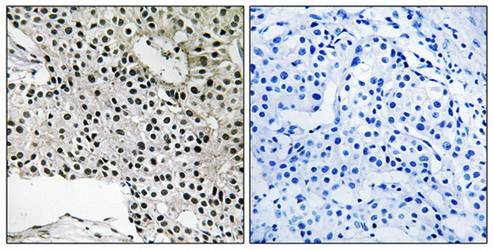 TCEAL4 antibody