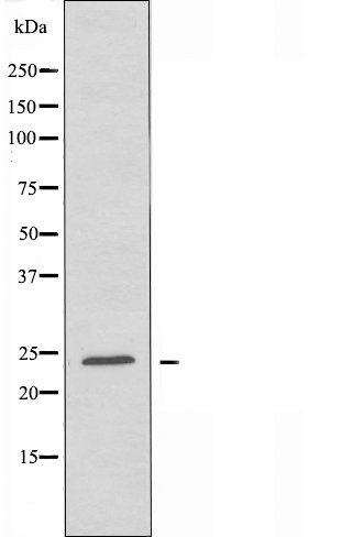 TCEAL6 antibody
