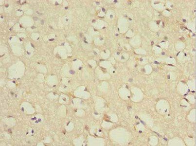 TCEAL7 Antibody