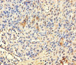 TCEANC2 Antibody