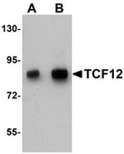 TCF12 Antibody