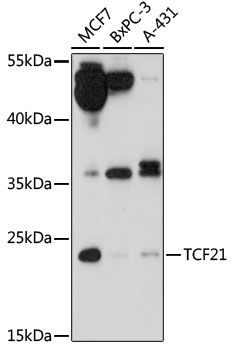 TCF21 antibody
