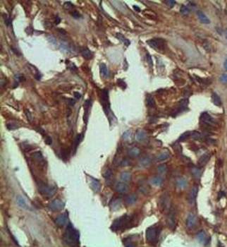 TCF7L2 Rabbit Polyclonal Antibody