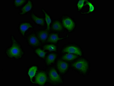 TCHH Antibody