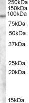 Goat anti-TCHHL1 Antibody