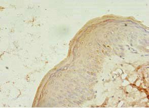 TCHP Antibody