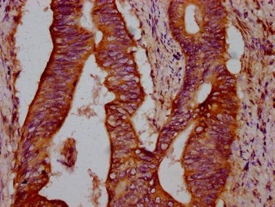 TCIRG1 Antibody