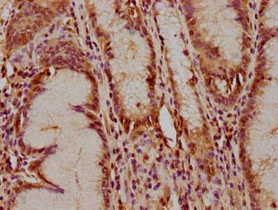 TCL1B Antibody