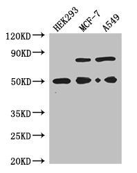 TCN2 antibody