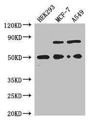 TCN2 Antibody