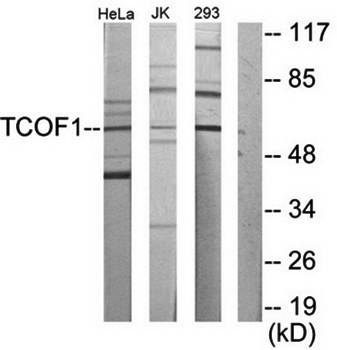 TCOF1 antibody