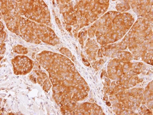 TCP1 beta Rabbit Polyclonal Antibody