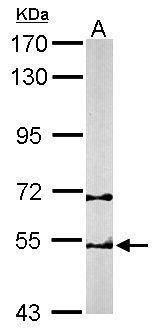 TCP1 beta Rabbit Polyclonal Antibody