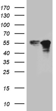 TCP1 delta (CCT4) antibody