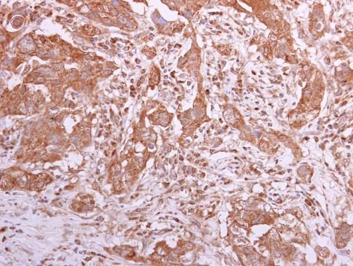 TCP1 theta Rabbit Polyclonal Antibody