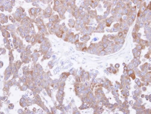 TCP1 theta Rabbit Polyclonal Antibody