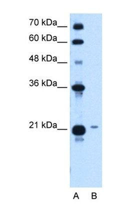 TCP10L antibody