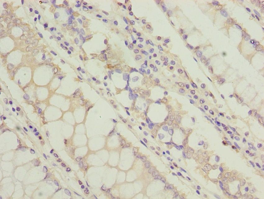 TCTA Antibody