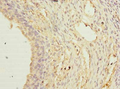 TCTEX1D2 Antibody