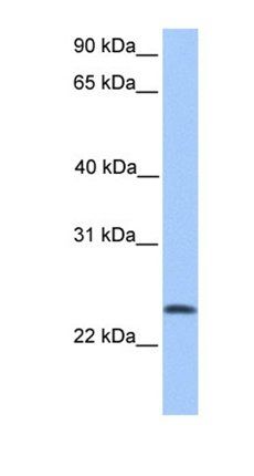 TCTEX1D4 antibody