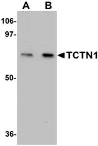 TCTN1 Antibody