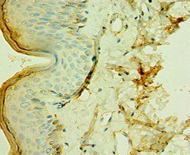 TCTN2 Antibody