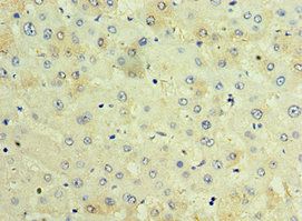 TCTN2 Antibody