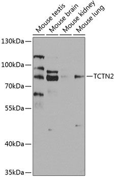 TCTN2 antibody