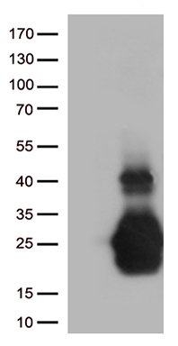 TDO2 Antibody