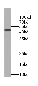 TDP-43 antibody