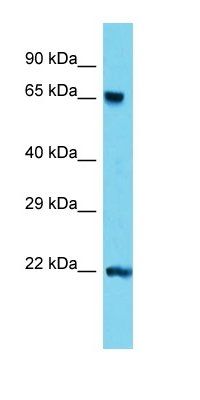 Tdp1 antibody
