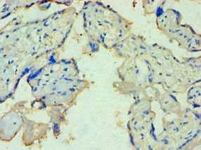 TDP1 Antibody
