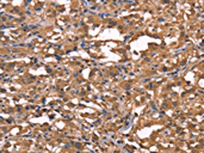 TDP2 antibody