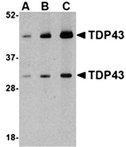 TDP43 Antibody