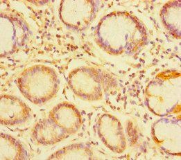 TDRD1 Antibody