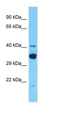 TDRD12 antibody