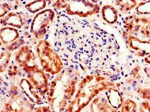TDRD12 Antibody