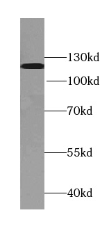 TDRD5 antibody