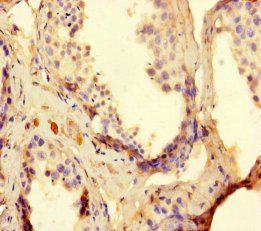 TDRD9 Antibody