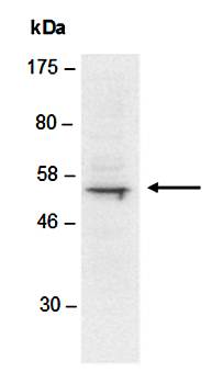 TDT (M) Antibody, Rabbit Polyclonal