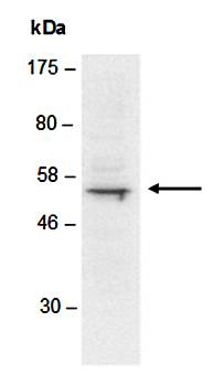 TDT antibody