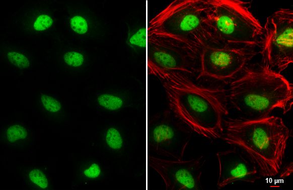 TEA domain transcription factor 4 Antibody