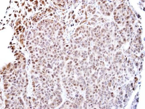 TEAD4 Rabbit Polyclonal Antibody