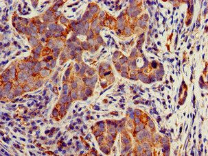 TECPR2 antibody