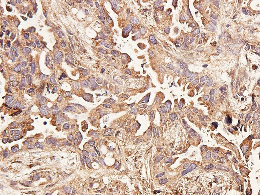 TEK Rabbit Polyclonal Antibody